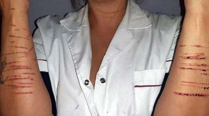 Ocurrió en Mar del Plata: Una mujer frenó en un semáforo y un hombre se le metió en el auto para violarla